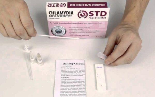 A home chlamydia test kit. (Creative Commons)